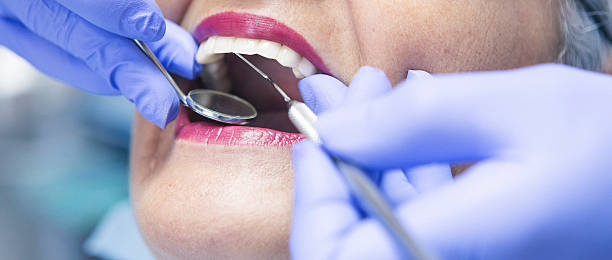 Best Urgent Care for Lost Fillings or Crowns in Hudson Falls, NY
